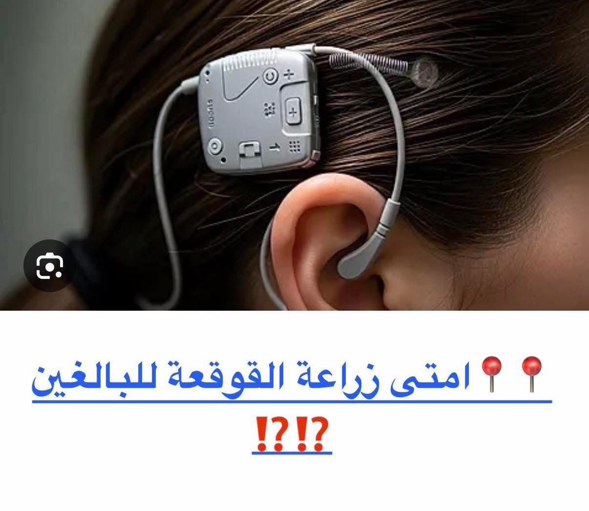 6True6's tweet photo. 📌 اختيار الحالة الصح
📌 جراحة دقيقة
📌 برمجة وتأهيل سمعي مستمر

💬 لو السماعة الطبية بطلت تساعدك…
ممكن تكون زراعة القوقعة هي الحل المناسب ليك
#نجران_الآن 
#السعوديه_العظمى https://t.co/LeiT8iZstg