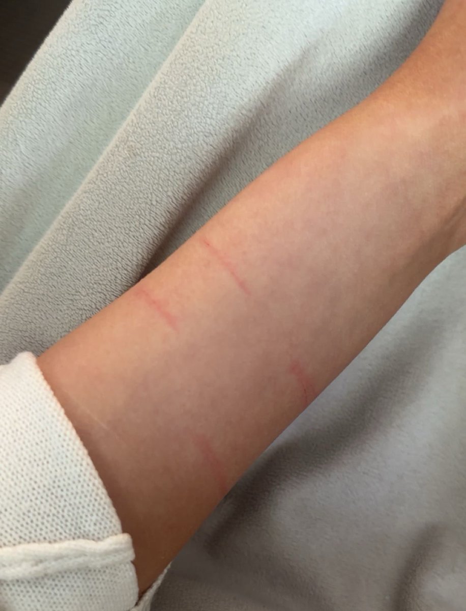cream13010's tweet photo. this is what i get for cutting myself NO FUCKING BLOOD https://t.co/WJCRaCdXrb