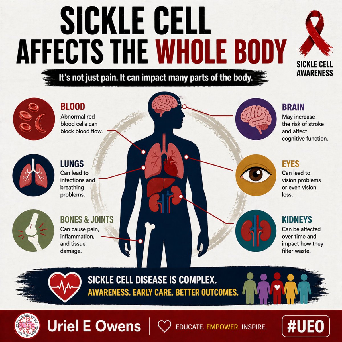 UEO Sickle Cell tweet media