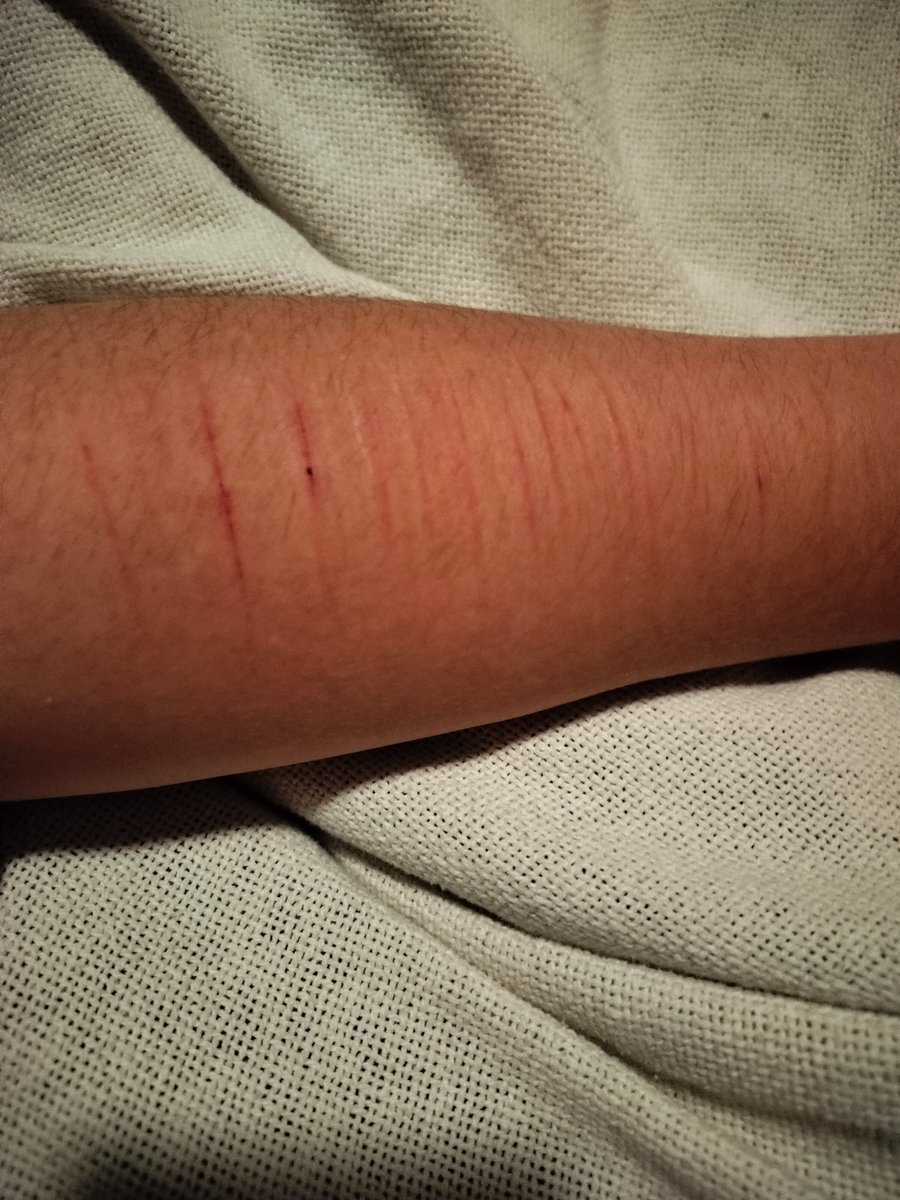mexicoofshtwt's tweet photo. The blade I used was #dull but I #thug blehhh
Fake, sfx makeup
#slitwt #988twt #shtwt https://t.co/SgloA4LIpY
