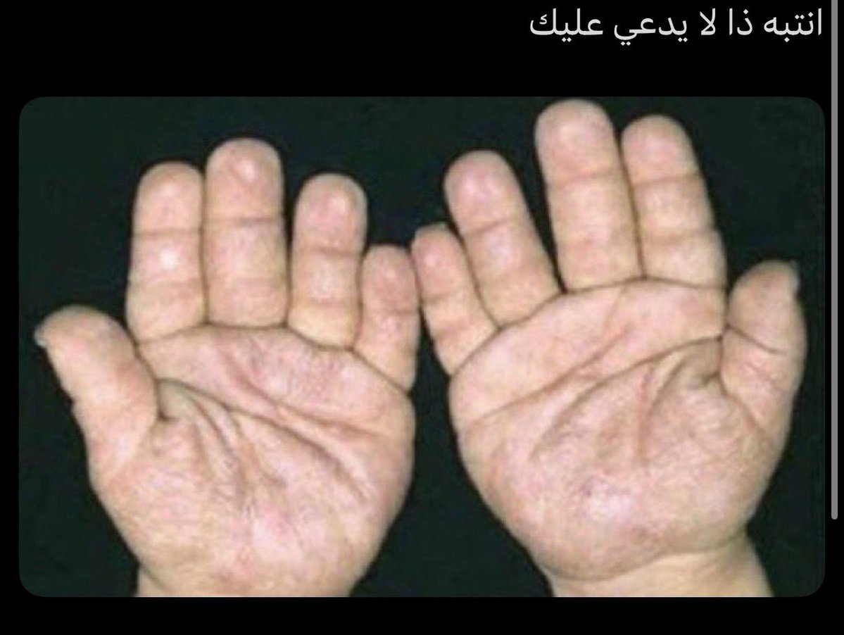 خالد tweet media