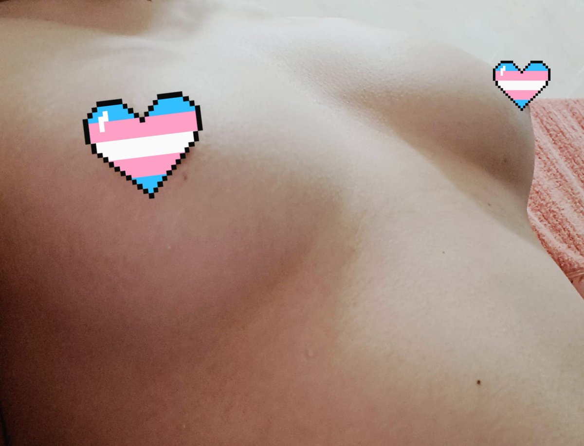 MelissaKisses 🏳️⚧️ tweet media