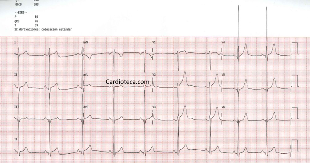 CardioTeca tweet media