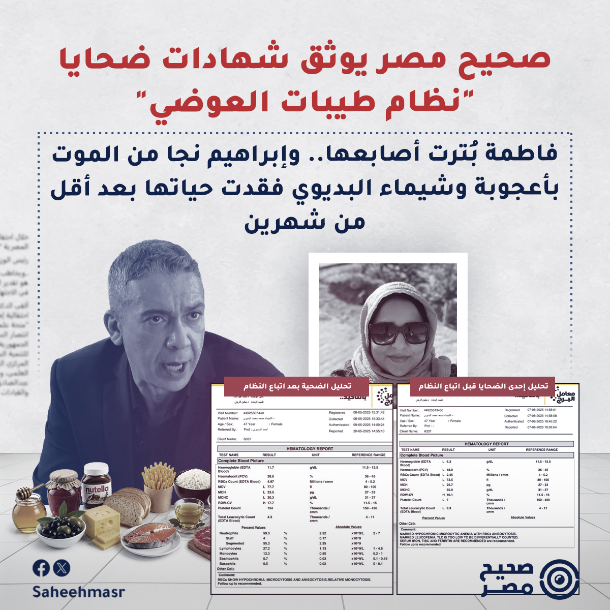 SaheehMasr's tweet image. 🔴 في ديسمبر 2023، قررت جامعة عين شمس فصل الطبيب ضياء العوضي من منصبه كأستاذ لمادة التخدير بكلية الطب، وذلك على خلفية شكوى من طلاب اتهموه بالترويج لمعلومات طبية مزيفة داخل محاضراته. في الشهر نفسه، كانت فاطمة محمد علي (اسم مستعار بناءً على رغبة المريضة)، وهي مريضة سكر تبلغ من