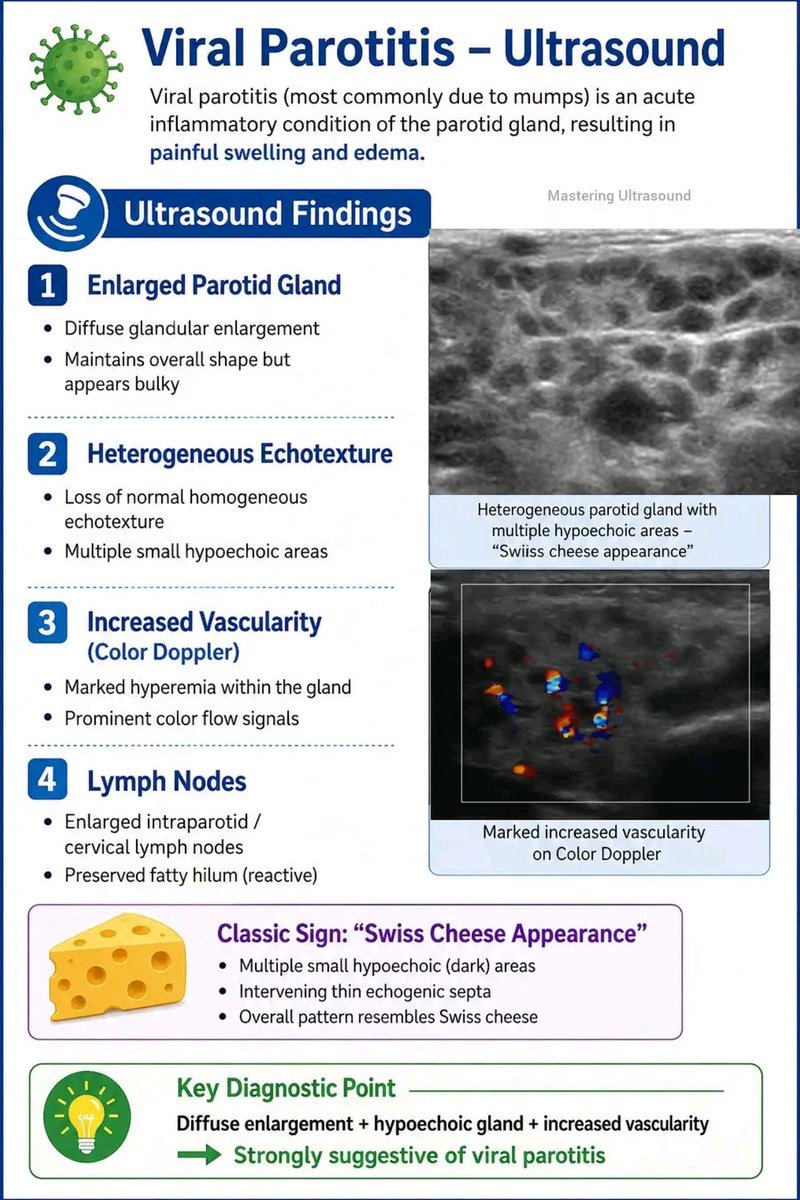 mznljrdy47597's tweet photo. 🦠 Viral Parotitis – Ultrasound
#parotitis #viralparotitis #masteringultrasound #adnannawazsangi #dradnannawaz t https://t.co/kWJyeAY2t4