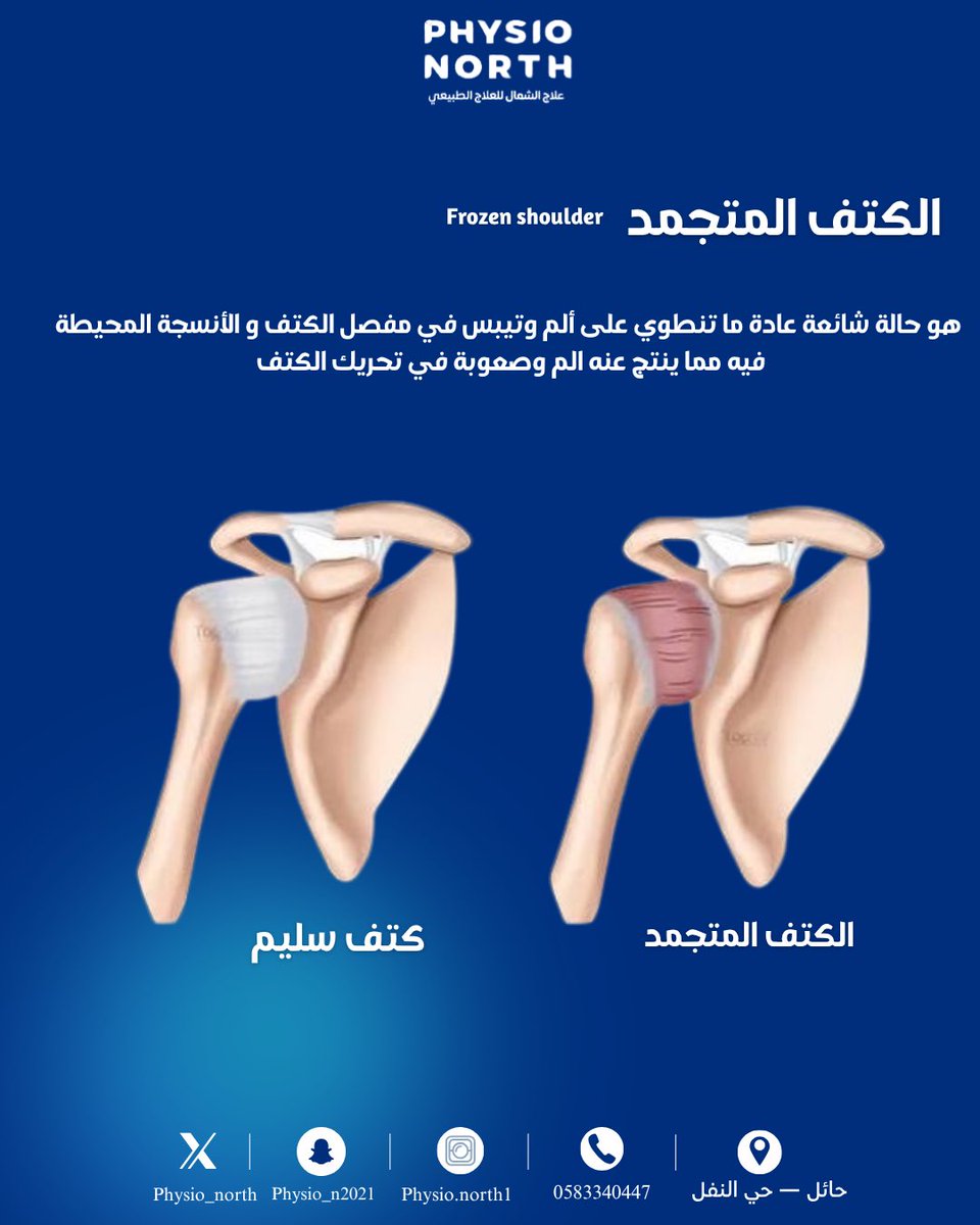 مركز علاج الشمال للعلاج الطبيعي | Physio North tweet media