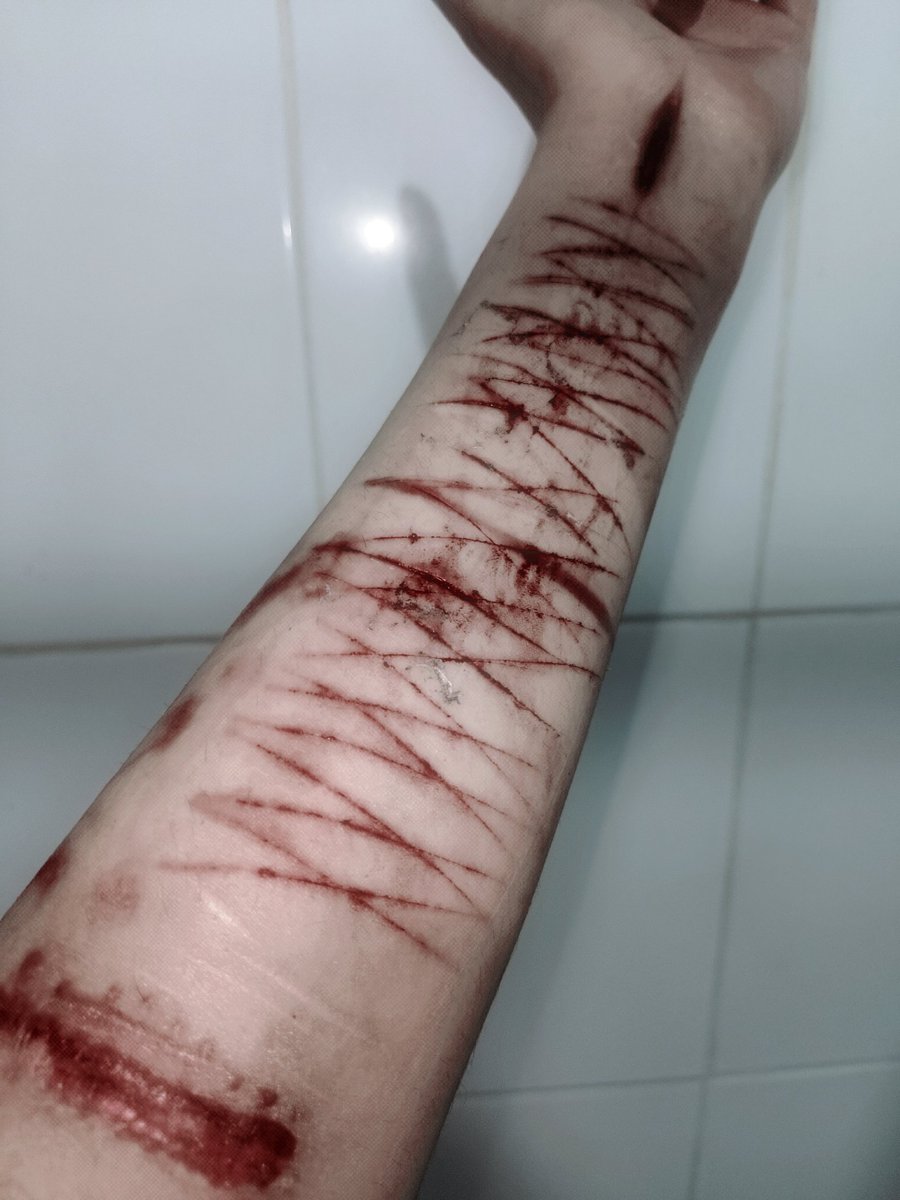 fresiitapunketa's tweet photo. 𝓜𝒊𝒔 𝓒𝒊𝒄𝒂𝒕𝒓𝒊𝒄𝒆𝒔 #shtwt #selfharms https://t.co/XjerXCqdBU