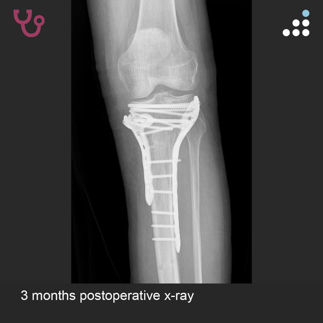 Orthobullets tweet media