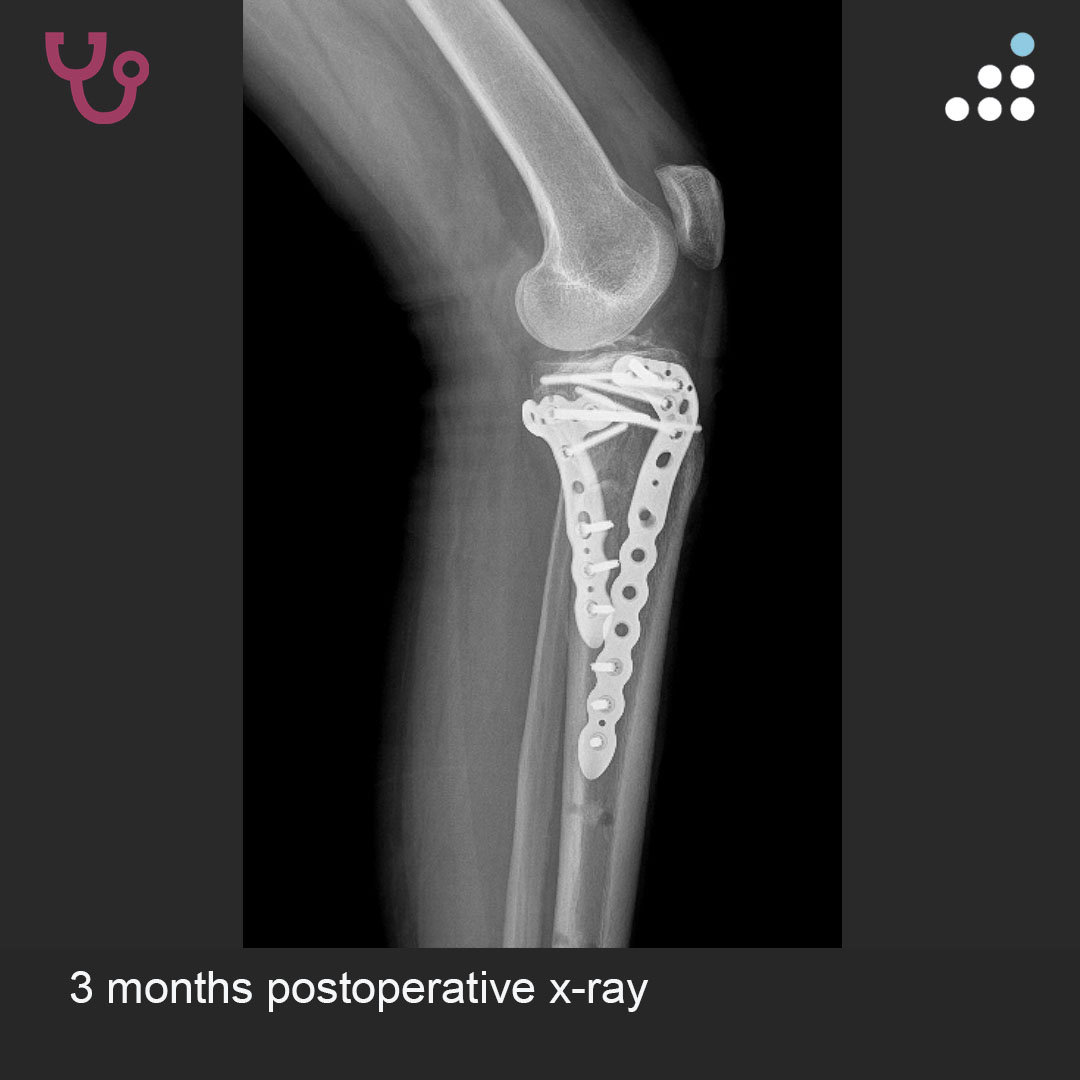 Orthobullets tweet media