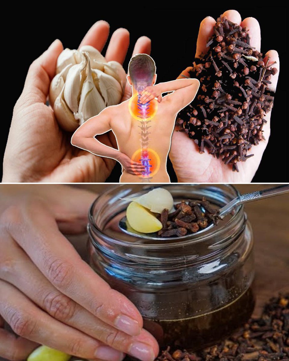 FSibobugin28099's tweet image. 🧄🍯Power of nature with this potent trio: garlic, honey, and cloves! Boost your immunity, improve digestion, and promote overall well-being with this easy-to-make remedy. 

Get the recipe and benefits of this ancient remedy!  #NaturalRemedies #HealthTips #Wellness 

👇🧵