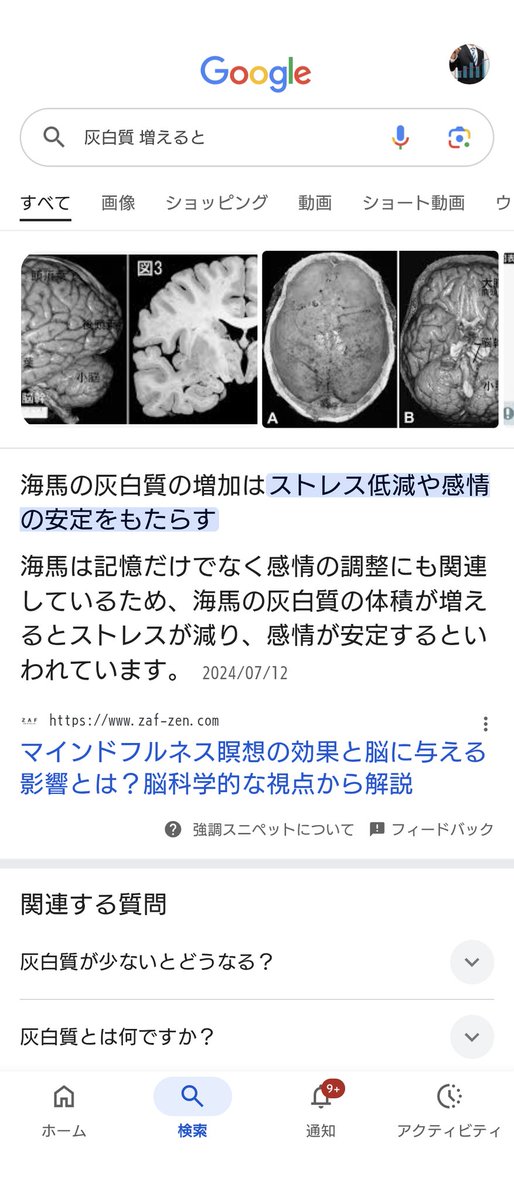 翔_KAKERU tweet media