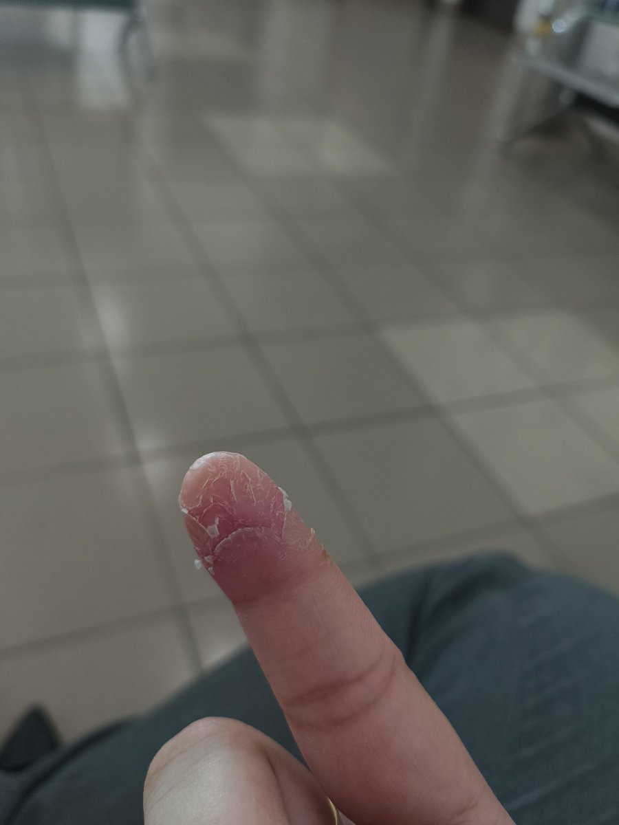 Ex zurista here too! Rasanya dah lebih 10 kali pergi clinic and hospital dpt rawatan. Last² bagi 1 month letter resign. My first and last kerja fnb especially Barista 😭