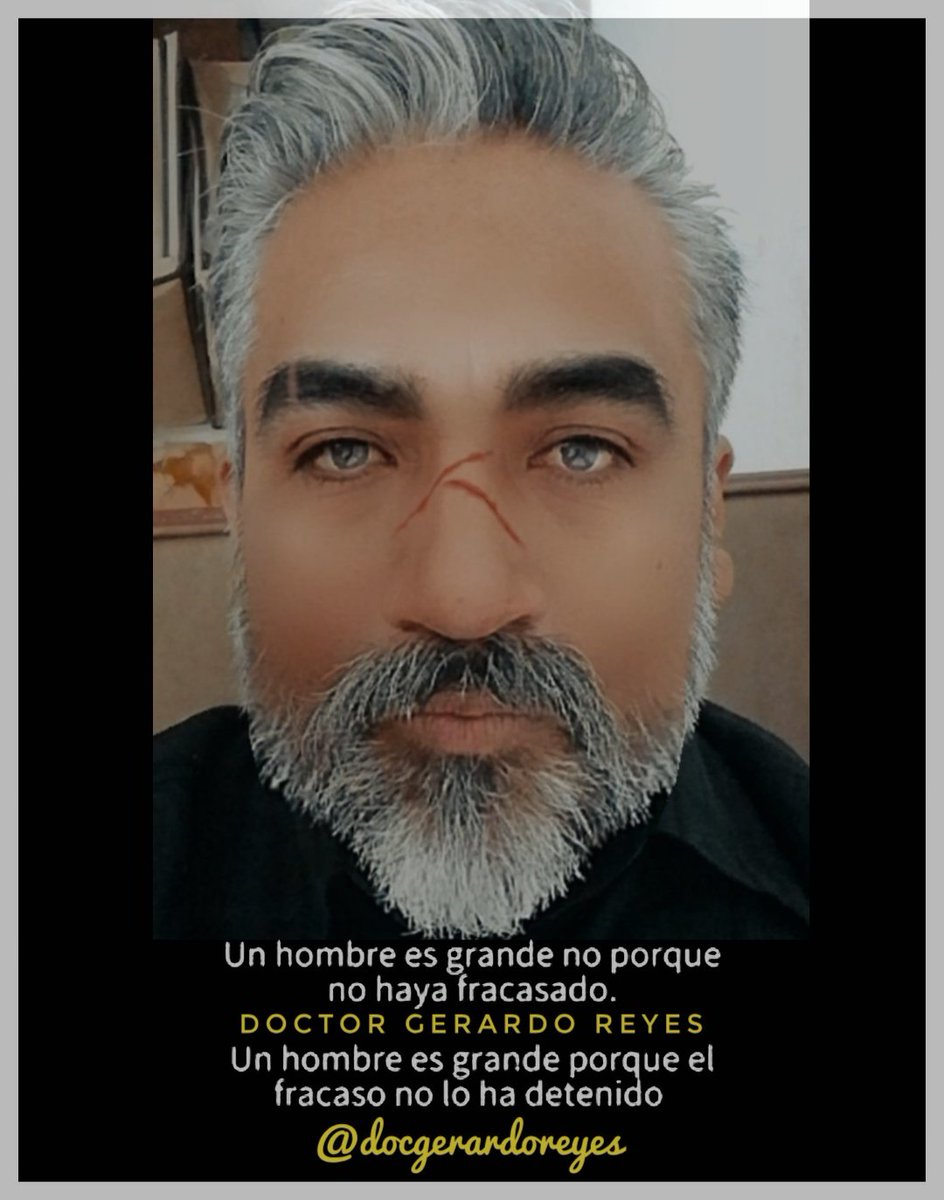 NOS ENSEÑARON QUE EL FRACASO ES LO OPUESTO AL ÉXITO 🤔
PERO NO:
EL FRACASO ES PARTE DEL PROCESO PARA LLEGAR AL ÉXITO 🎖