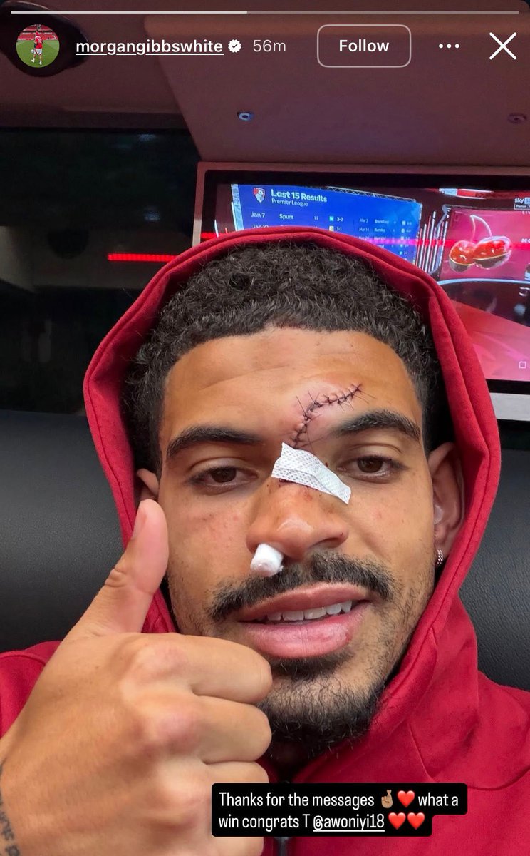 Footballtweet's tweet photo. 📱 Morgan Gibbs-White has posted a positive update on Instagram following his painful head collision against Chelsea. 

🤕 Looks a sore one. https://t.co/jMwLlIktib