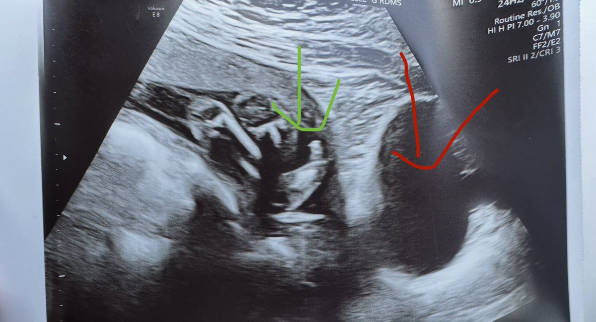 AconitePrincess's tweet photo. Visual confirmation of being kicked in the bladder. 😂🥴 https://t.co/lYfQ9OdzkR