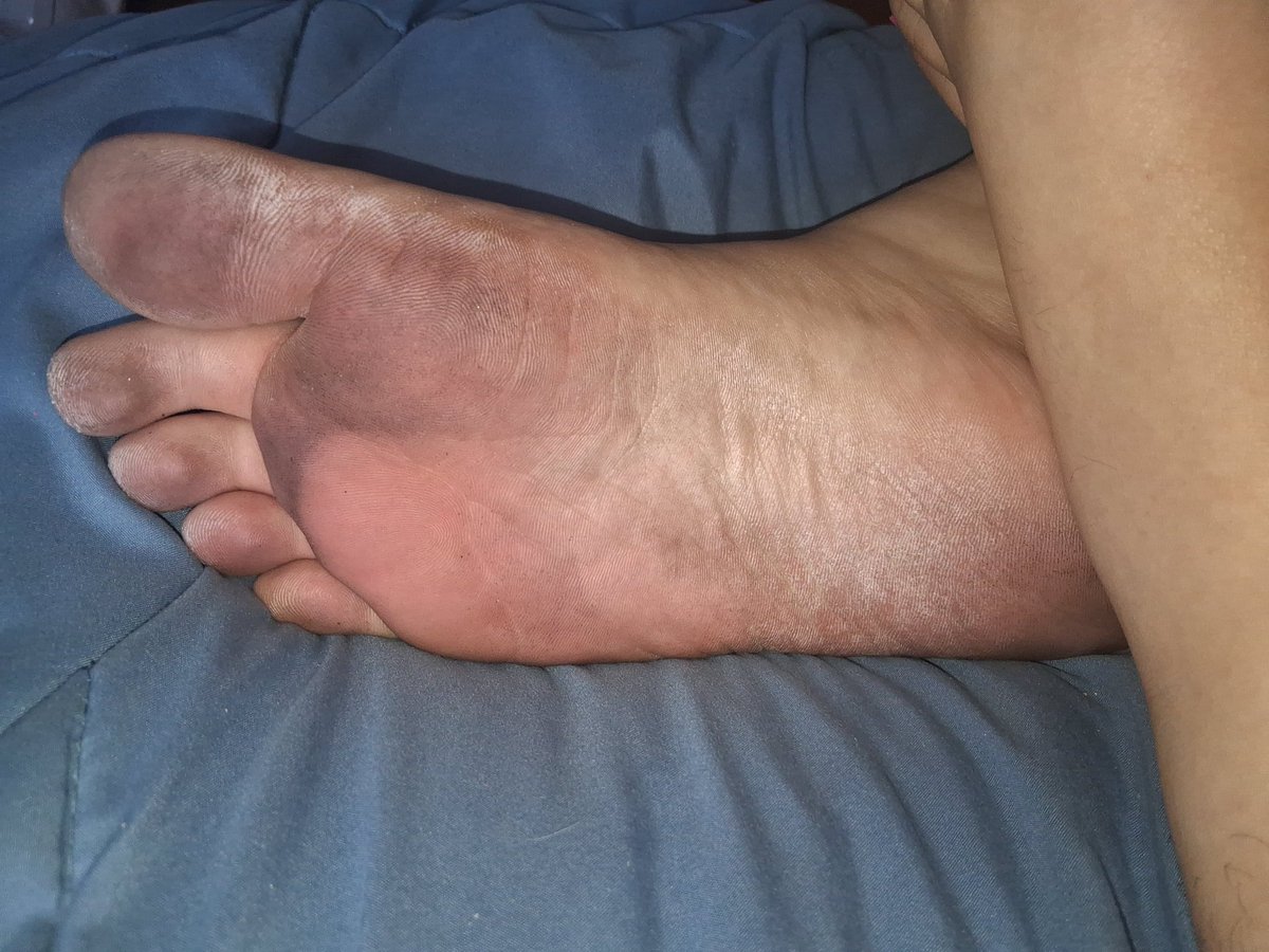 goddess_iris_08's tweet photo. After a barefoot walk in the park. 
Tops or bottoms? 😘💋 https://t.co/zYcBHM89bb