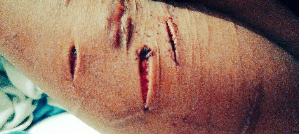 MaturanaSa24596's tweet photo. Para retomar siento que están decentes, mini styros que me hice en la madrugada ;b

#shedtwt #bloodtwt #shtwt #shtw #cutspo #cutspotwt #scarpo #scarpotwt https://t.co/oGewlmK17q
