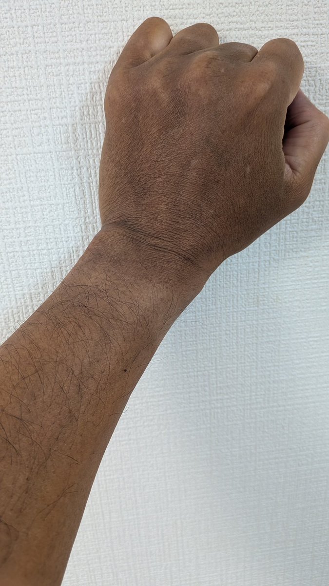 ハワイで日焼けしてきた☀🐻
