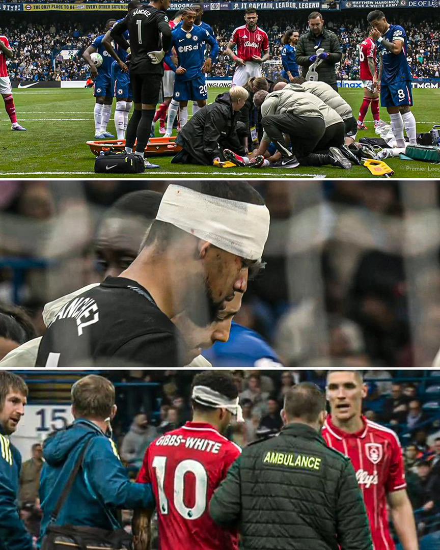 Seeing his SKULLL the first picture 

Shout out to all the Medical staff 

Gibbs-White's injury after collision with Sanchez.