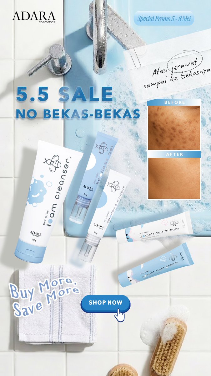 Adara_ID's tweet image. 💙 5.5 SALE NO BEKAS-BEKAS! 💙

Saatnya upgrade skincare routine kamu bareng ADARA!
Biar kulit bersih, mulus, dan glowing tanpa drama bekas jerawat 💧🫧

📅 Special Promo 5 - 8 Mei
🛍️ Buy More, Save More!
🔥 Jangan sampai kehabisan ya!

#skincare #acnetreatment #makeup
