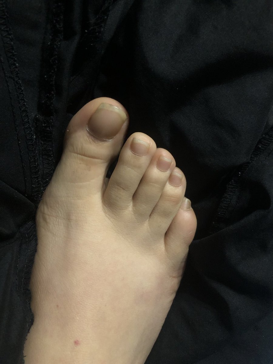 Baby Foot Mx🇲🇽 tweet media