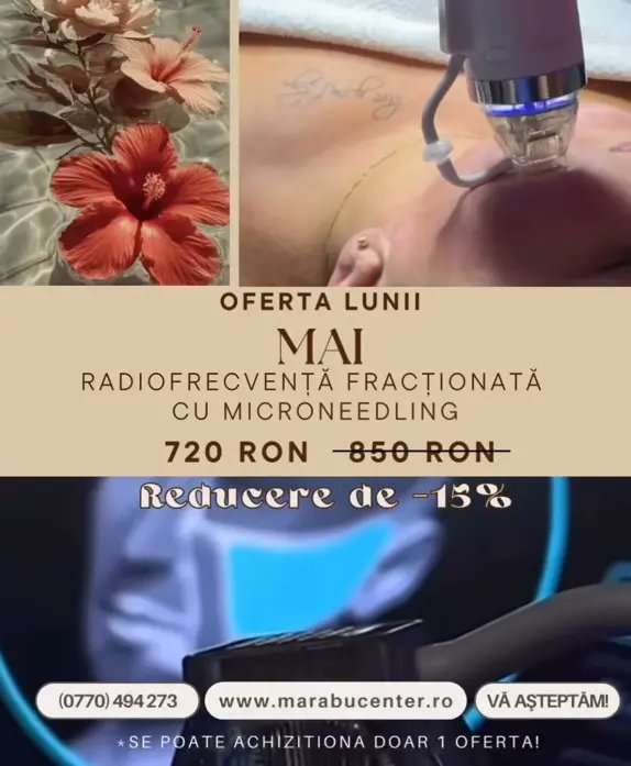 marabucenter's tweet photo. Radiofrecvență fracționată cu microneedling în Bacău – tratament modern pentru o piele mai fermă și mai luminoasă ✨
✔ stimulează colagenul în profunzime
✔ îmbunătățește textura pielii
✔ efect vizibil de rejuvenare
💰 Oferta Mai: 720 RON (–15%)
https://t.co/AwYs63xXQp https://t.co/7GaRlKmhJR