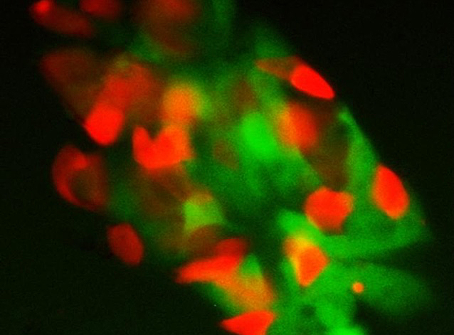 BPoD_s's tweet photo. GSK3α enzyme identified as a checkpoint in stem cell fate – when inhibited self-renewal capacity is maintained

📷 Duo Wang &amp; Xiukun Wang et al Ying Lab @KECKSchool_USC &amp; National Institute of Environmental Health Sciences in @cell_res 
➡️ https://t.co/8ZZJNSuiUh with @rooph https://t.co/Ny9C9Ngo6F