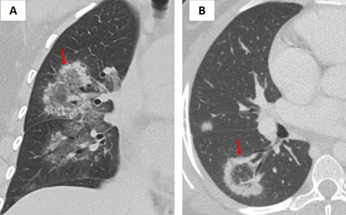 RADIOLOGISTS tweet media