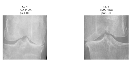 affanned399's tweet photo. #ReinforcementLearning #MetaLearning #FederatedLearning #EdgeAI #ExplainableAI #XAI #Interpretability #GradCAM #SHAP #FairAI #EthicalAI #MedicalAI #KneeOA #Ai_Dissertation #KneeOA_Detection_Deep_Learning #Biomechanics #MEdical_ai #x_ray https://t.co/3qS7ySyQwL