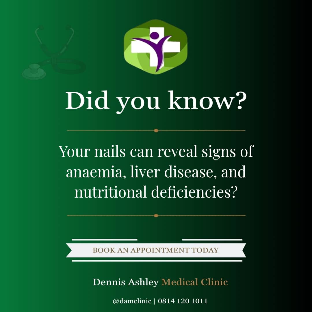 DAMClinic's tweet photo. The doctor's first clue isn't always your chest or your blood.

Sometimes, it's your fingernails.
Pale nails. Ridges. Unusual curves. 

These are your body's early warnings for anaemia, liver disease &amp; nutritional deficiencies.
Don't ignore the signs. Book now 👇
📞 0814 120 1011 https://t.co/leDbP6iJLR