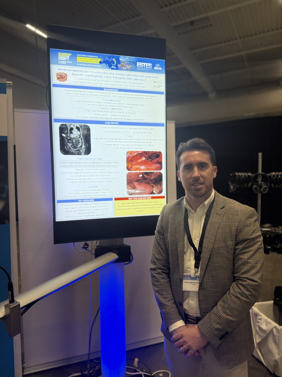 andreumartinezh's tweet photo. Great experience at #ECTES2026 & #WCTC🇸🇪🌍
Co-directed #MiniEVTM, speaker in Plenary hall, chair in poster sessions, uniposter presentation, ESTES committee meetings…
Outstanding professionals worldwide, shaping the future of #Trauma & #EmergencySurgery 🚀
Ready for more! https://t.co/RitJU553UB