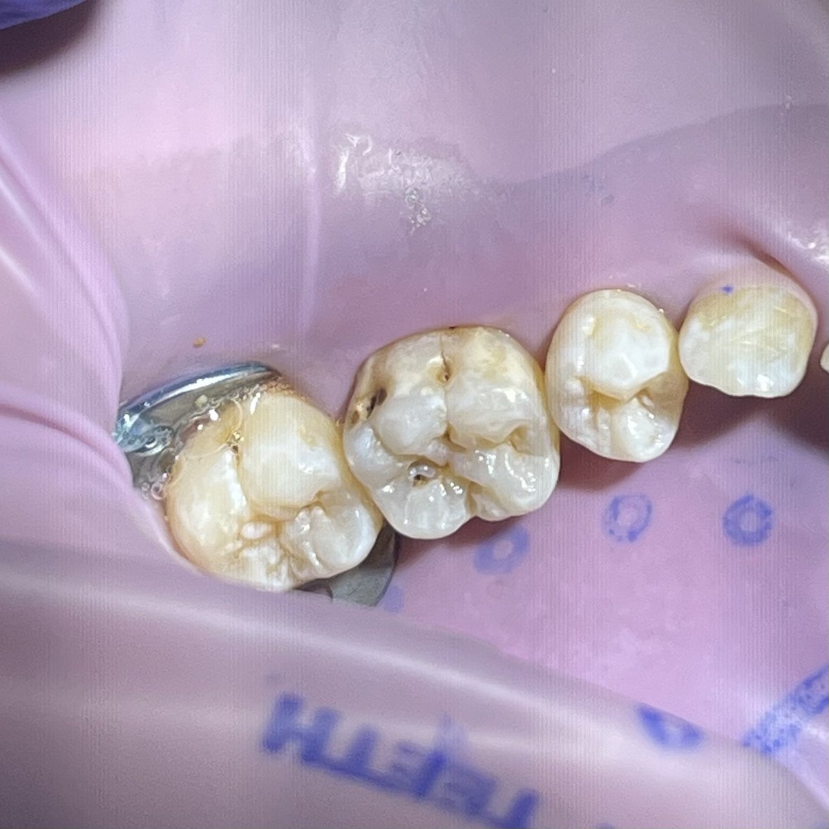 F99lz's tweet photo. Today’s Resto Case🧼
-ALT- https://t.co/qrFoKSG2Ll