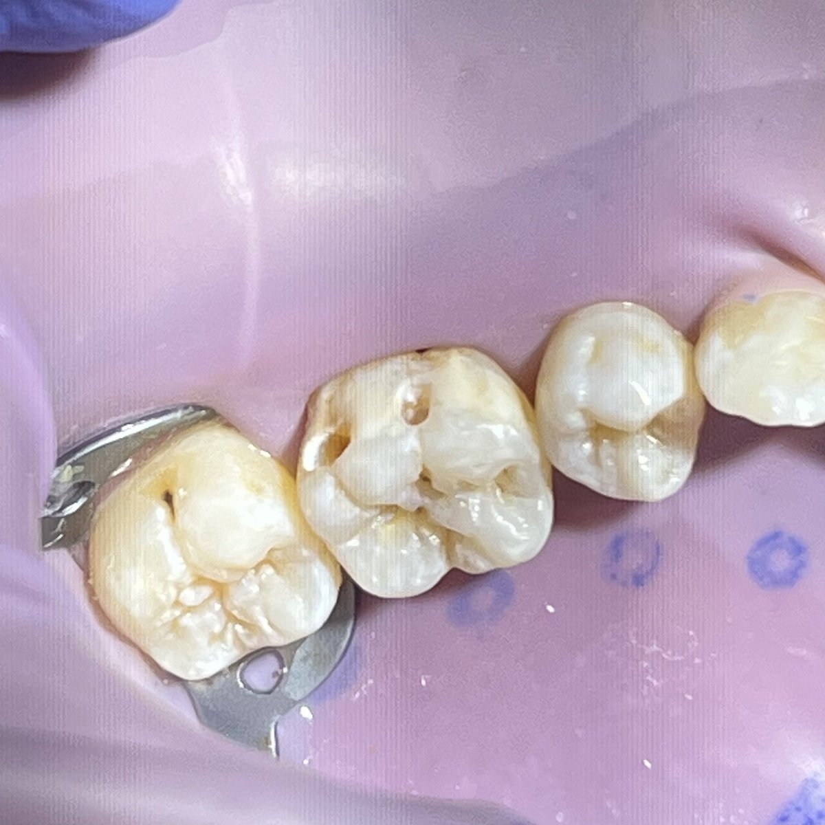 F99lz's tweet photo. Today’s Resto Case🧼
-ALT- https://t.co/qrFoKSG2Ll