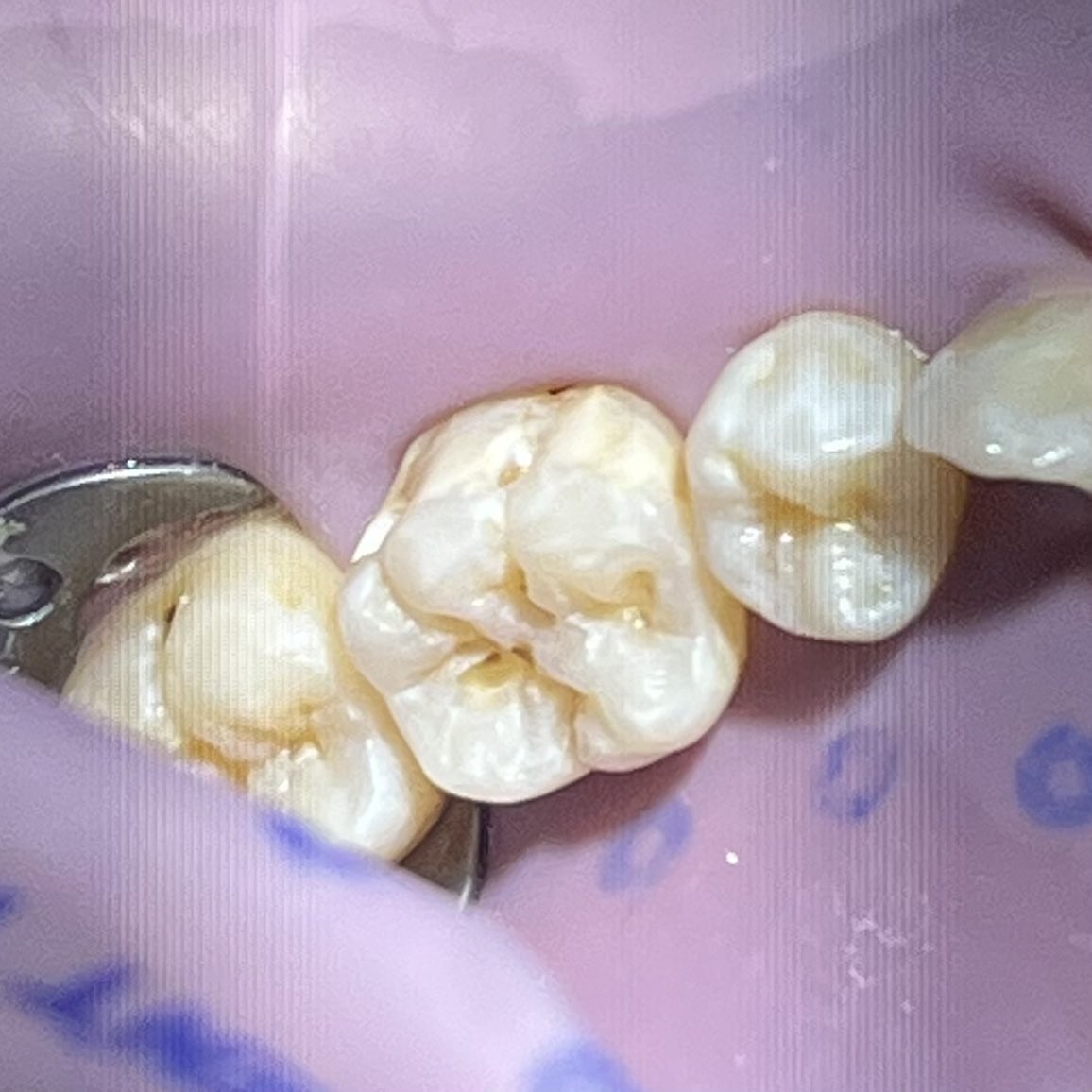 F99lz's tweet photo. Today’s Resto Case🧼
-ALT- https://t.co/qrFoKSG2Ll