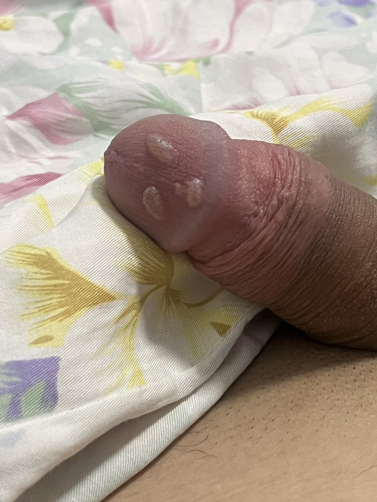 粪坑母猪 tweet media