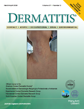 ACDS_Dermatitis's tweet photo. The March/April 2026 issue of the Dermatitis Journal is available! Check out the latest at https://t.co/JmhfZs3Af8 #ACDS_Dermatitis #DermatitisJrnl #patchtesting #dermatitis #medtwitter #dermtwitter #aadmember #learn https://t.co/b6DKNhAMcU