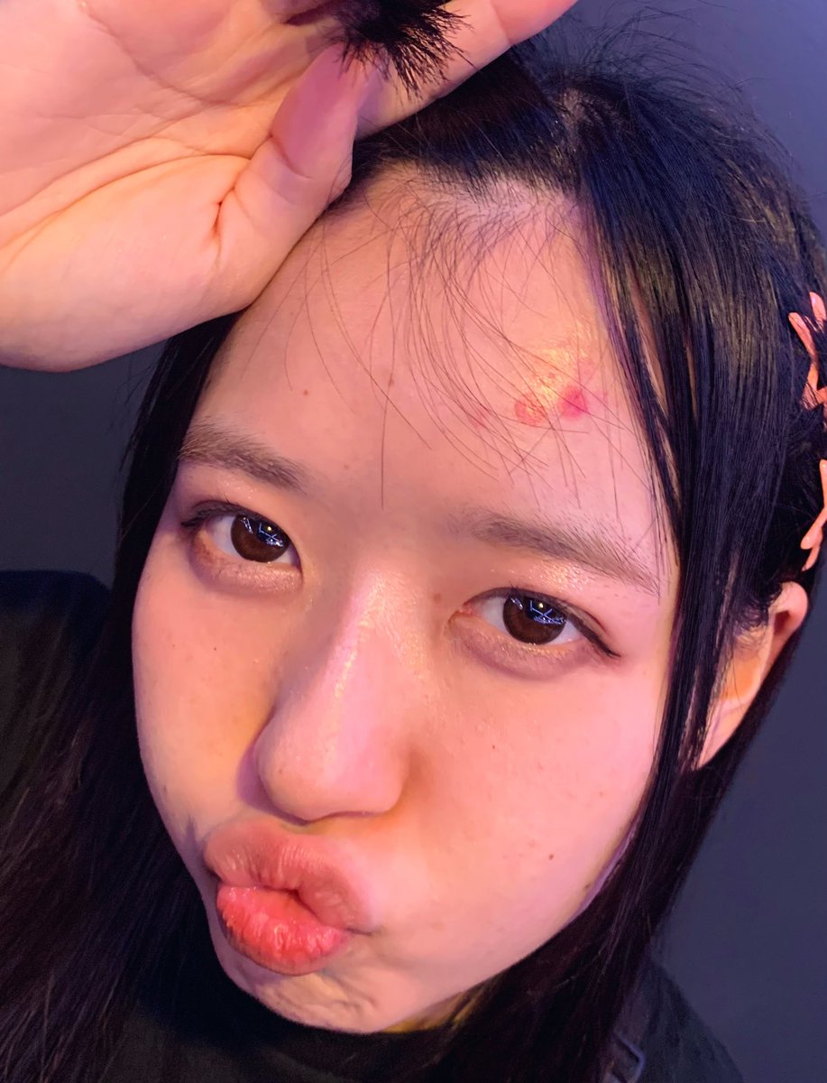 たんこぶひよこ🐥😭お大事に…
#服部つばめひよこ口保存委員会