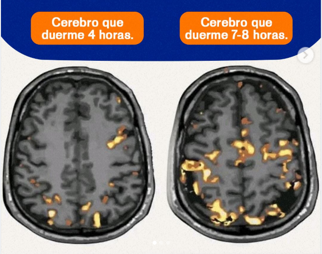 MariaAvefor's tweet photo. 3. Dormir no es opcional.
La memoria se consolida mientras duermes.
Quitarle horas al sueño para “estudiar más”
es, literalmente, perder rendimiento.
Y, ahora, lo más importante:
Trabaja con método, no con miedo. https://t.co/RsBVF8TkCp