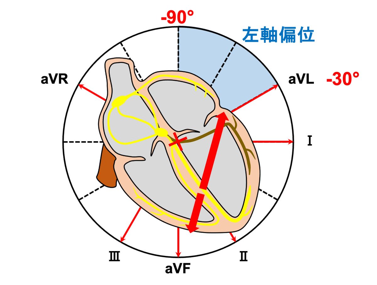 心電図.com tweet media