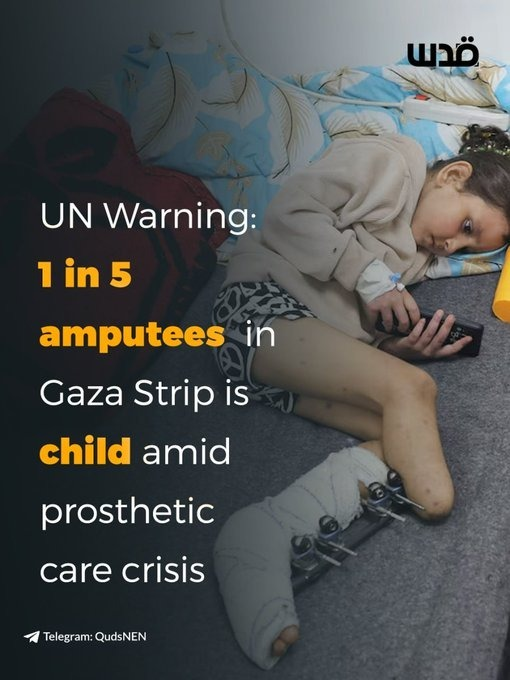 MarioNawfal's tweet photo. 🇵🇸 Gaza has over 6,600 people waiting for prosthetic and rehabilitation care.

Only 8 technicians available to handle them all.

That's 825 patients per specialist, and 1 in 5 of those amputees is a child.

The tragedy never ends.

Source: UN OCHA https://t.co/zdsHT3yBz1