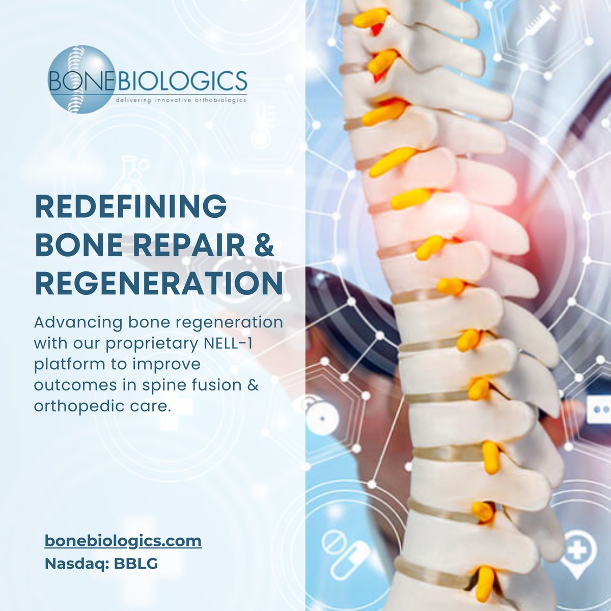 BoneBiologics's tweet photo. $BBLG is advancing bone regeneration through its proprietary NELL-1 platform, a recombinant protein designed to promote targeted, controlled bone formation and provide targeted bone regeneration for “hard healers” with an advantageous safety profile.

https://t.co/fSCW4t5oXA https://t.co/9DkDsKbocG