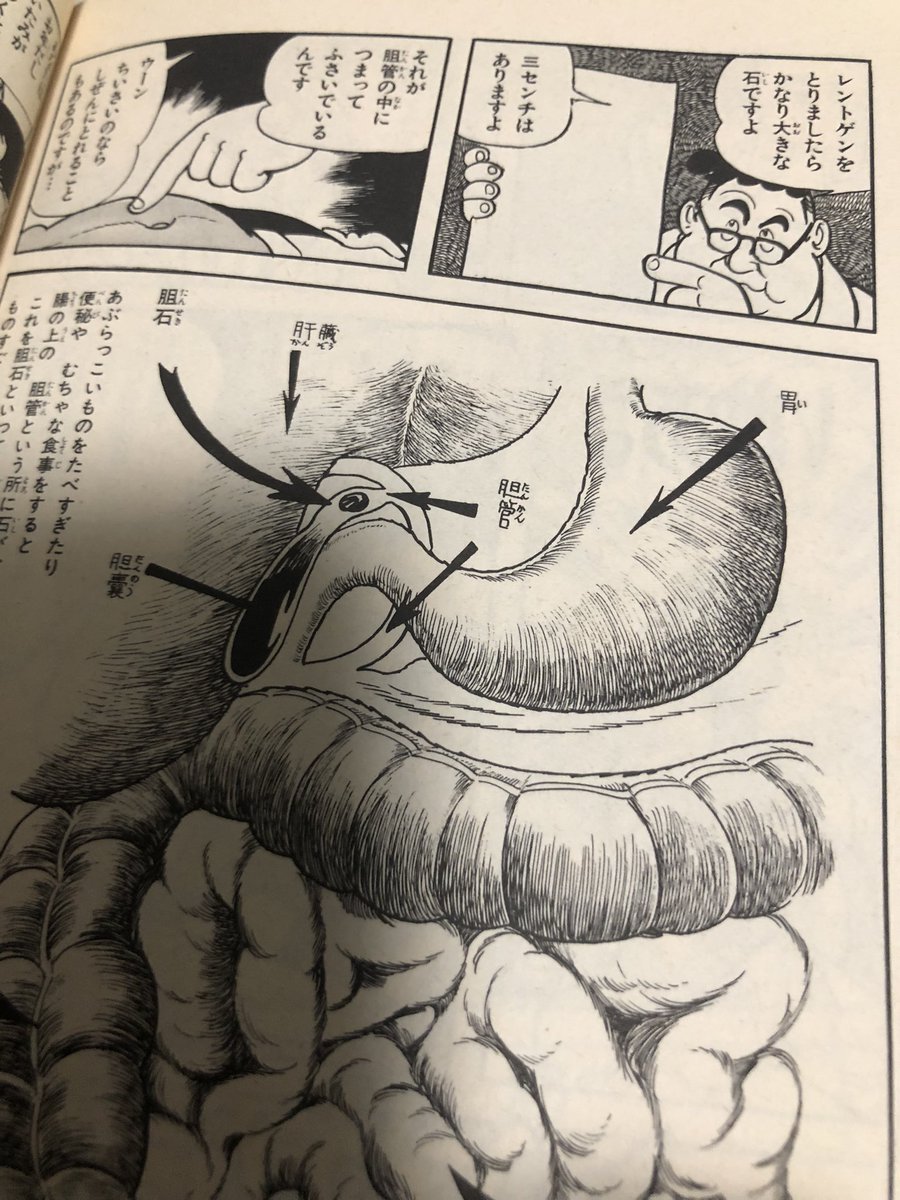 Dr_Koshiro's tweet photo. ブラックジャックの時代は胆石の確定診断is 腹部レントゲン写真であることを知ったGW💘 https://t.co/BEL4W5SOGE