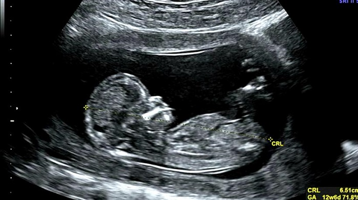 LifeNews.com tweet media