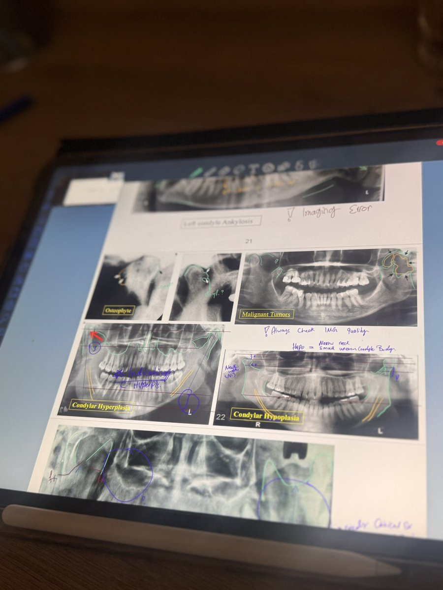 studywithvee's tweet photo. Radiology 🩻

#studytwt #radiology #finalsprep https://t.co/ftBWnRJvxz