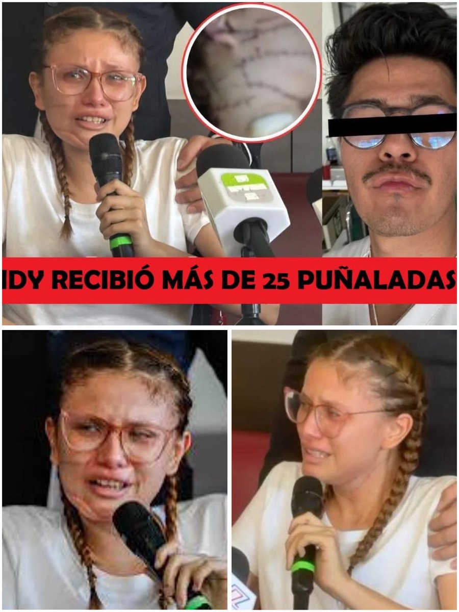 🚨ME 4PUÑ4L0 25 VECES.. NO SE DEJE COMPAR SEÑOR JUEZ!🚨
Imagínate ser Wendy.. una mujer que vivo en carne propia lo que NADIE MERECE VIVIR..
Su esposo, aquel que me prometió amor incondicional.. INTENTO DESVIVIRLA..
Estudiante de enfermería que anhelaba ayudar a las personas..