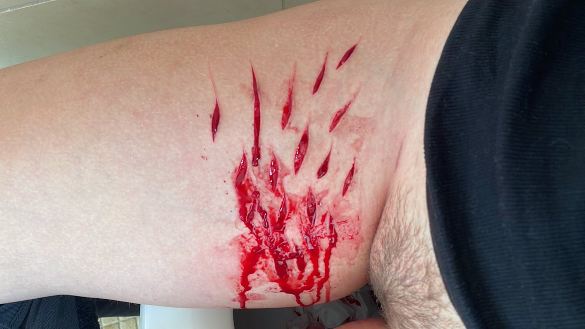 cutiecutstwt's tweet photo. Finally reaches beans guys holy fuck this is great!!! #goretwt #slittwt #shtwt #selfharms #selfharm https://t.co/ymJrZrHgfC