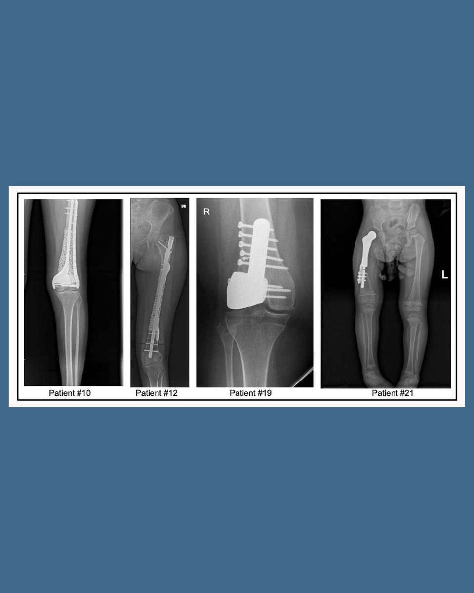 Bone & Joint Open tweet media