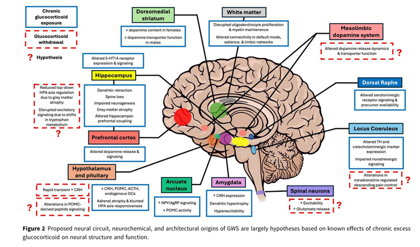 sociedadSEEN's tweet photo. Potential mechanisms of the glucocorticoid withdrawal syndrome
* El síndrome de abstinencia de glucocorticoides es una consecuencia frecuente y clínicamente significativa de la reducción de la exposición crónica a glucocorticoides endógenos o exógenos.
https://t.co/U5dj9VSVhr
@NeuroendocrinoS
