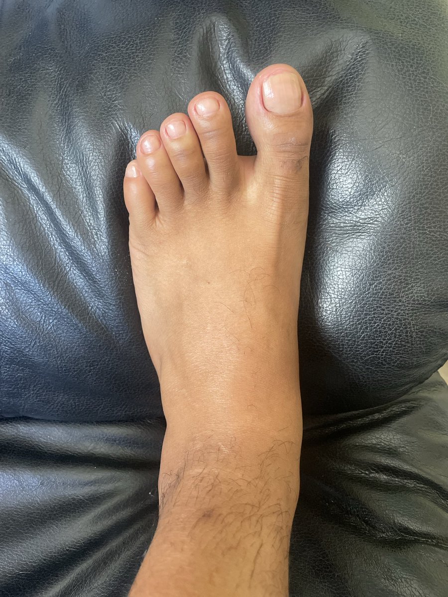 Fiz a unha dos pés agora to com tesão no meu pé 🦶🏾 e vocês, curtiram ?