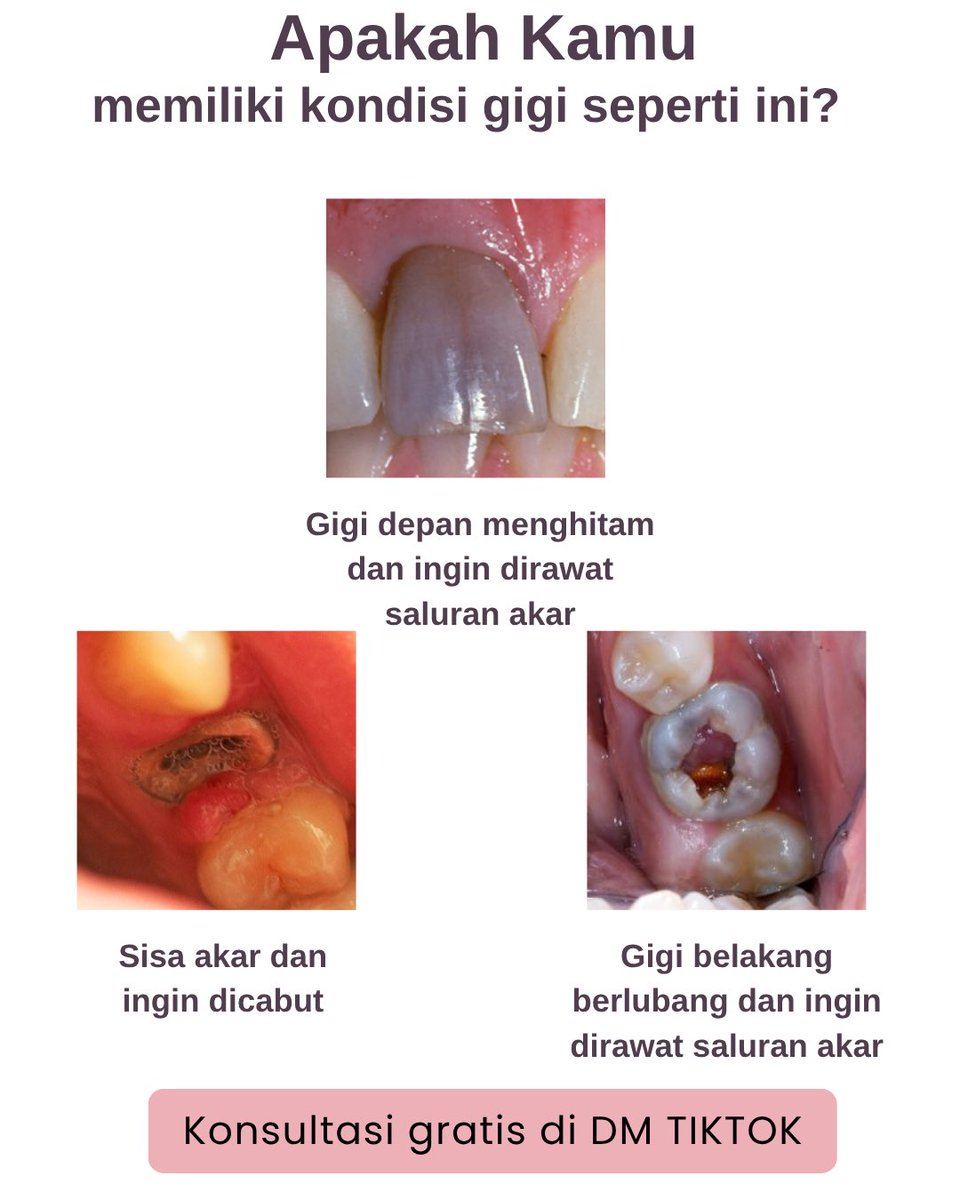 xo, dental coass🧚 tweet media